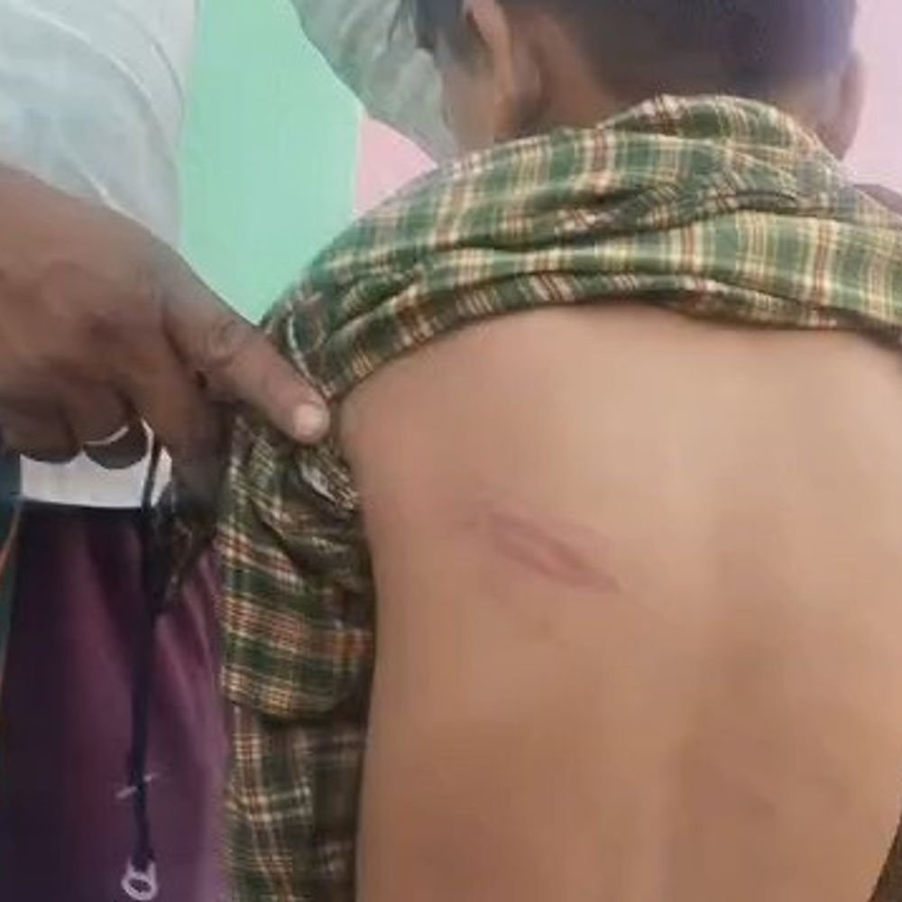 सवाल का जवाब न देने पर छात्र की पिटाई:सीतापुर में पिता ने शिक्षिका पर आरोप लगाए, एसडीएम से शिकायत