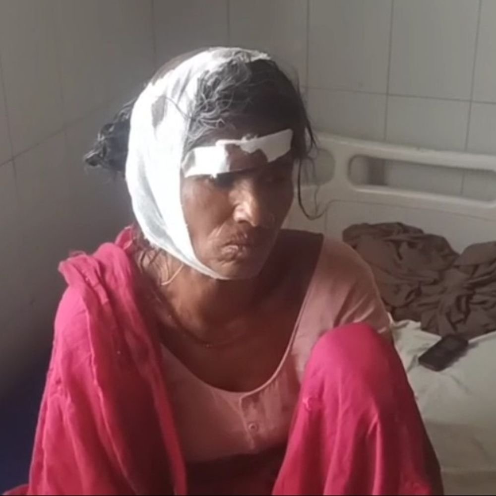 बहराइच में पागल कुत्ते ने छह लोगों को काटा:एक महिला गंभीर घायल, जिला अस्पताल में इलाज जारी