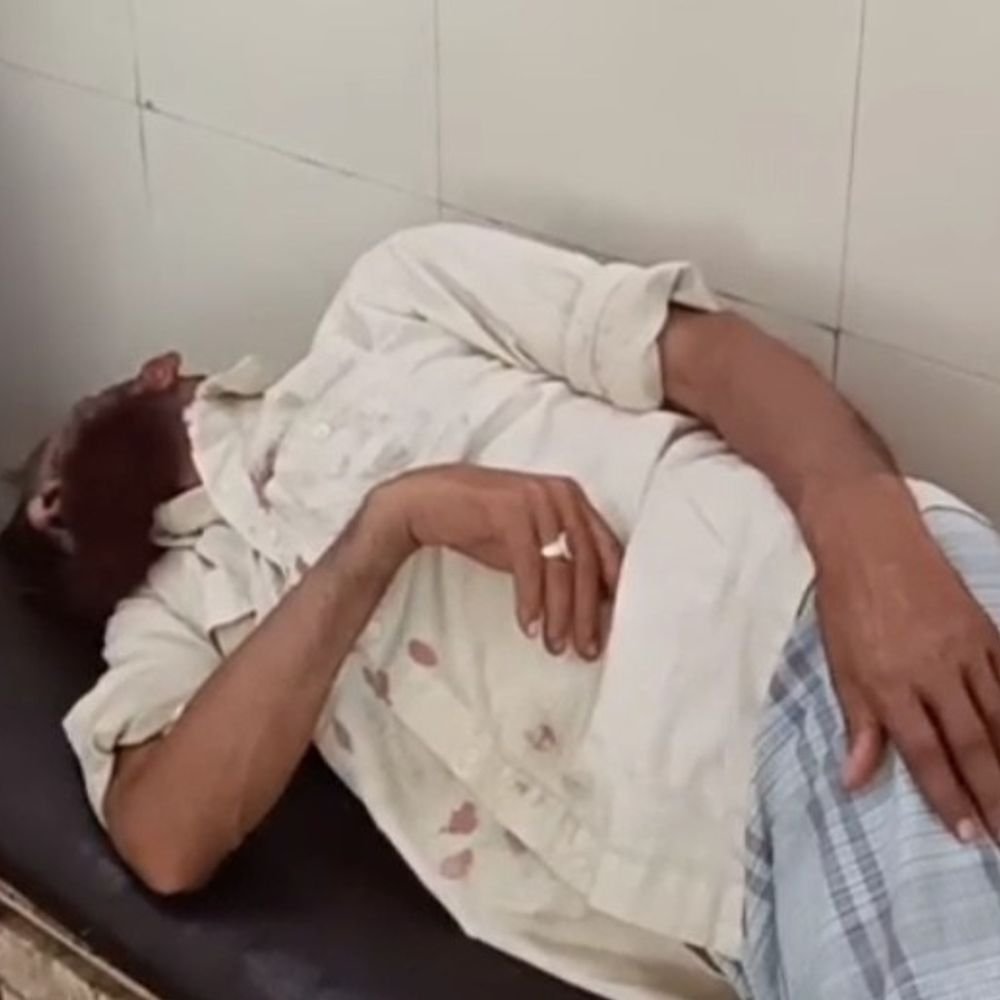 बहराइच में किसान पर बंदर का हमला:धान की रोपाई करते समय सिर पर किया वार, जिला अस्पताल में भर्ती