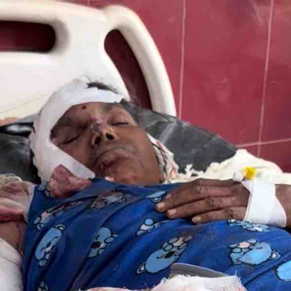 रामपुर में स्पीड ब्रेकर बना हादसों की वजह:एक घंटे में 2 दुर्घटनाएं, 5 लोग घायल, चेतावनी बोर्ड लगाने की मांग