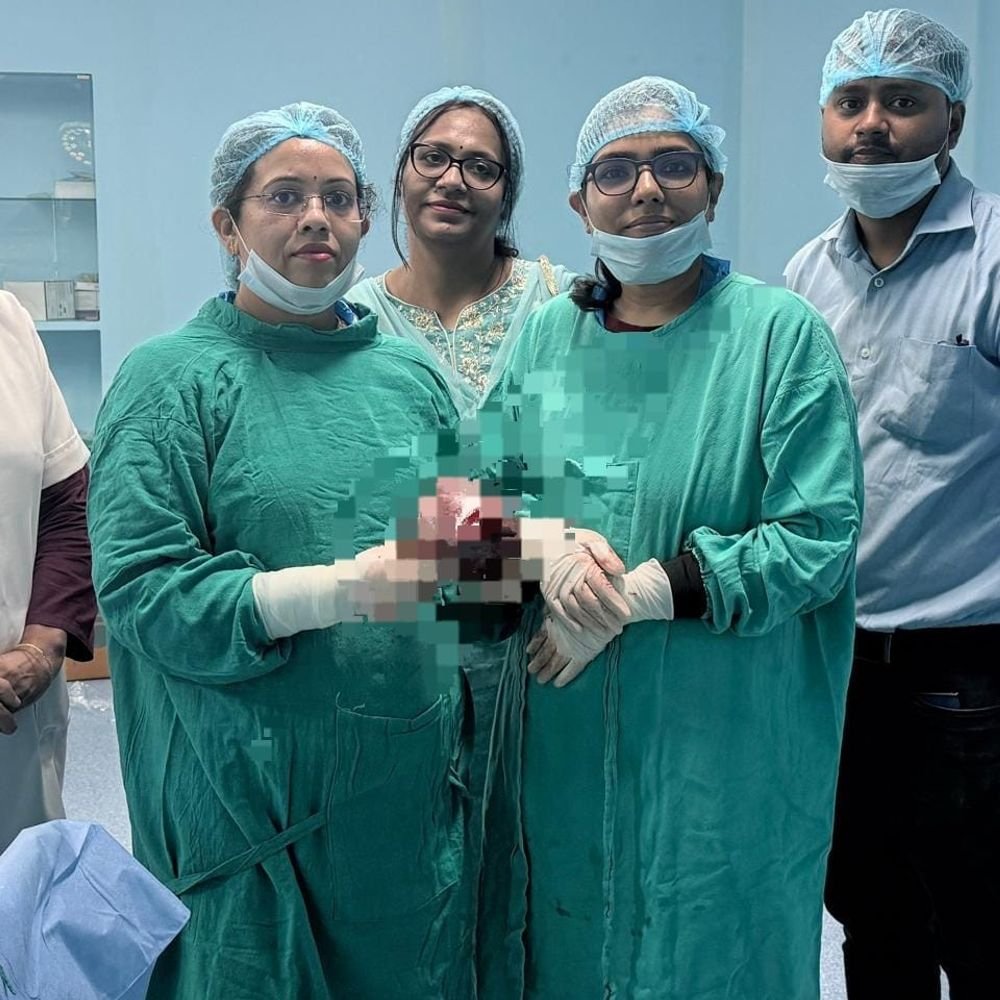 एटा मेडिकल कॉलेज में डेढ़ किलो ट्यूमर का सफल ऑपरेशन:महिला के अंडाशय से निकाला गया, गंभीर संक्रमण से बची जान