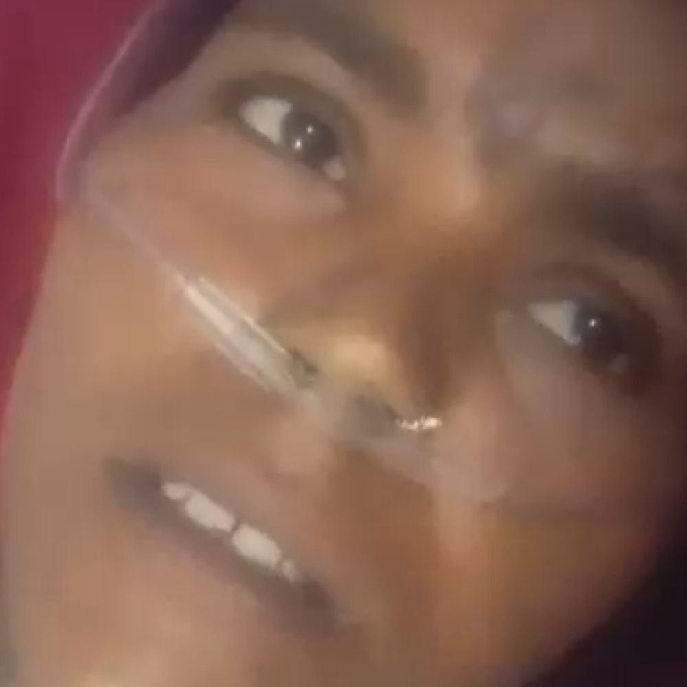 जालौन में आग से झुलसी महिला की मौत:परिजनों का आरोप- पति ने कमरे में बंद कर पेट्रोल डालकर जलाया